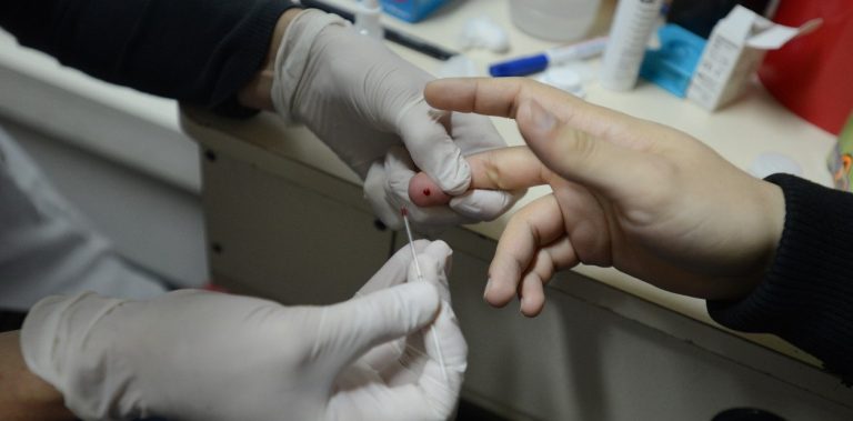 Caen a la mitad los testeos de VIH: dónde podés hacerte la prueba