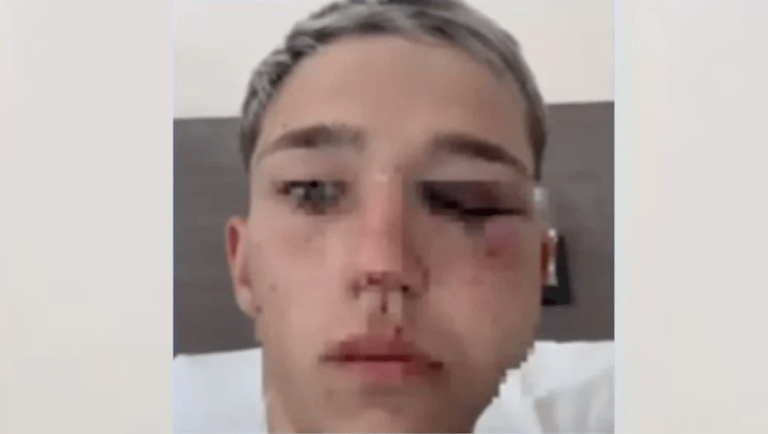 Quiénes son los cuatro rugbiers acusados de darle una paliza y desfigurar a un adolescente en una fiesta