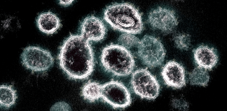 Detectan en Italia la variante AY.4.2 del coronavirus, más contagiosa que la Delta